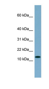 RPS27L antibody LS-C107860 Western blot of MCF7 cell lysate.
