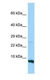 RPS28 antibody Western Blot of MDA-MB-435S.