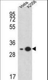 RPS3A Antibody western blot of HeLa,A2058 cell line lysates (15 ug/lane). The RPS3A antibody detected the RPS3A protein (arrow).
