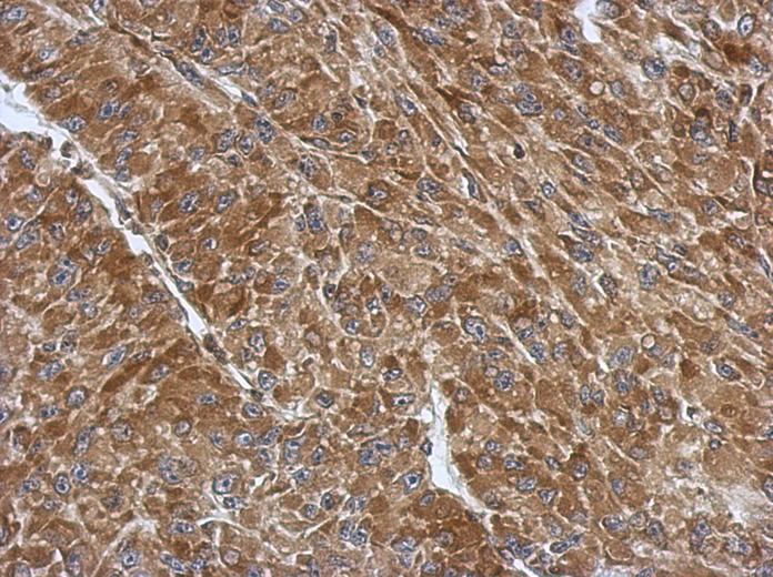 IHC of paraffin-embedded U87 xenograft, using RPS3A antibody antibody at 1:500 dilution.