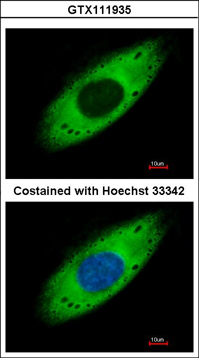 Immunofluorescence of paraformaldehyde-fixed HeLa, using RPS3A antibody at 1:500 dilution.