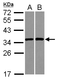 Sample (30 ug of whole cell lysate) A: A431 B: Raji 12% SDS PAGE RPS3A antibody diluted at 1:1000