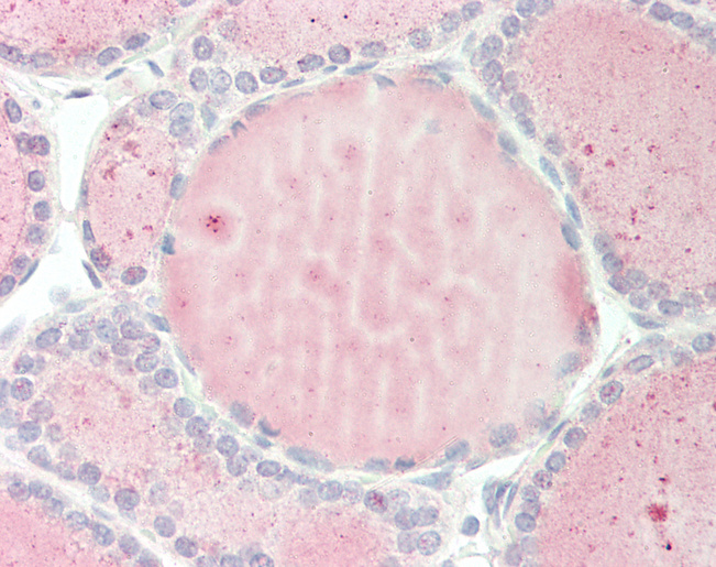 Human Thyroid: Formalin-Fixed, Paraffin-Embedded (FFPE)