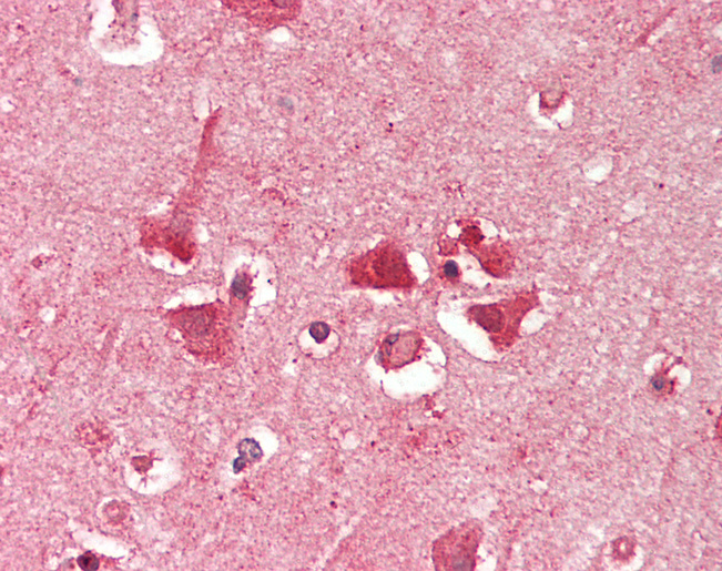 Human Brain, Cortex: Formalin-Fixed, Paraffin-Embedded (FFPE)