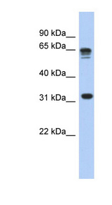 RPS3A antibody LS-C111816 Western blot of Fetal Liver lysate.