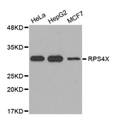 Western blot analysis of extracts of various cell lines, using SCAR antibody.