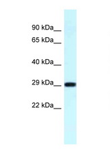 RPS4Y1 antibody LS-C145744 Western blot of Fetal Lung lysate. Antibody concentration 1 ug/ml.