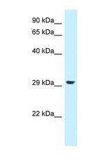 RPS4Y1 antibody LS-C145745 Western blot of 293T Cell lysate. Antibody concentration 1 ug/ml.