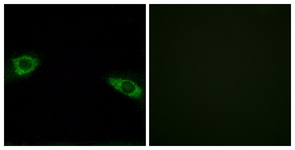 Immunofluorescence of HUVEC cells, using RPS4Y1 Antibody. The picture on the right is treated with the synthesized peptide.