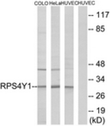Western blot of extracts from HUVEC/HeLa/COLO cells, using RPS4Y1 Antibody. The lane on the right is treated with the synthesized peptide.