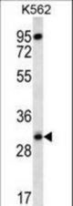 RPS4Y1 Antibody western blot of K562 cell line lysates (35 ug/lane). The RPS4Y1 antibody detected the RPS4Y1 protein (arrow).