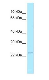 RPS5 antibody Western Blot of Fetal Lung.