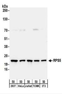 Detection of Human and Mouse RPS5 by Western Blot. Samples: Whole cell lysate (50 ug) from 293T, HeLa, Jurkat, mouse TCMK-1, and mouse NIH3T3 cells. Antibodies: Affinity purified rabbit anti-RPS5 antibody used for WB at 0.1 ug/ml. Detection: Chemiluminescence with an exposure time of 30 seconds.
