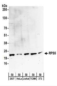 Detection of Human and Mouse RPS5 by Western Blot. Samples: Whole cell lysate (50 ug) from 293T, HeLa, Jurkat, mouse TCMK-1, and mouse NIH3T3 cells. Antibodies: Affinity purified rabbit anti-RPS5 antibody used for WB at 0.4 ug/ml. Detection: Chemiluminescence with an exposure time of 3 minutes.