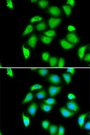 Immunofluorescence blot of U20S cell using RPS5 antibody. Blue: DAPI for nuclear staining.