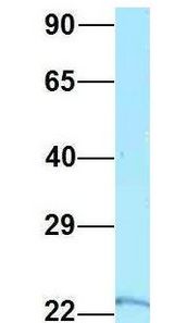 RPS5 antibody Western Blot of 293T lysate. Antibody Dilution: 1.0 ug/ml. RPS5 is supported by BioGPS gene expression data to be expressed in HEK293T. Antibody dilution: 1 ug/ml.