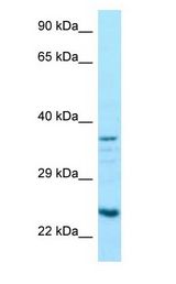 RPS5 antibody Western Blot of HCT15.
