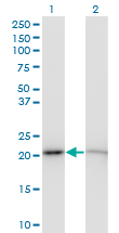 Western blot of RPS5 expression in transfected 293T cell line by RPS5 monoclonal antibody (M01), clone 3G3.