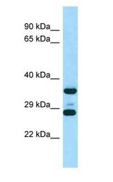 RPS6 / S6 antibody Western Blot of Rat Muscle.