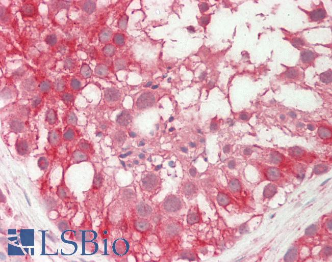 Human Testis: Formalin-Fixed, Paraffin-Embedded (FFPE)