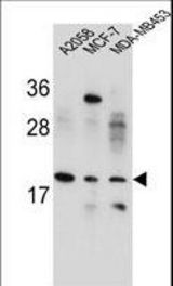 VCX1/VCX2/VCX3 Antibody western blot of A2058,MCF-7,MDA-MB453 cell line lysates (35 ug/lane). The VCX1/VCX2/VCX3 antibody detected the VCX1/VCX2/VCX3 protein (arrow).