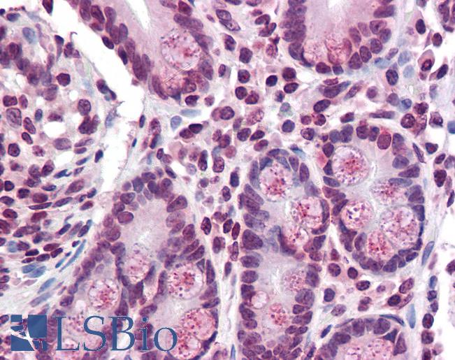 Anti-TMPRSS4 antibody LS-A9910 IHC of human small intestine. Immunohistochemistry of formalin-fixed, paraffin-embedded tissue after heat-induced antigen retrieval.