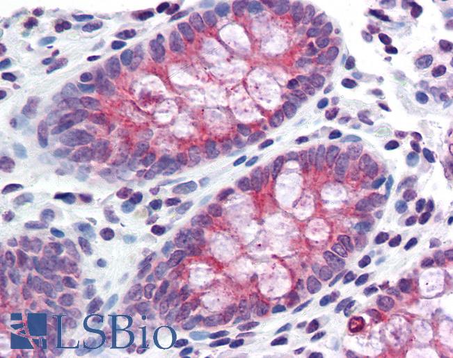 Anti-TMPRSS4 antibody LS-A9910 IHC of human colon. Immunohistochemistry of formalin-fixed, paraffin-embedded tissue after heat-induced antigen retrieval.