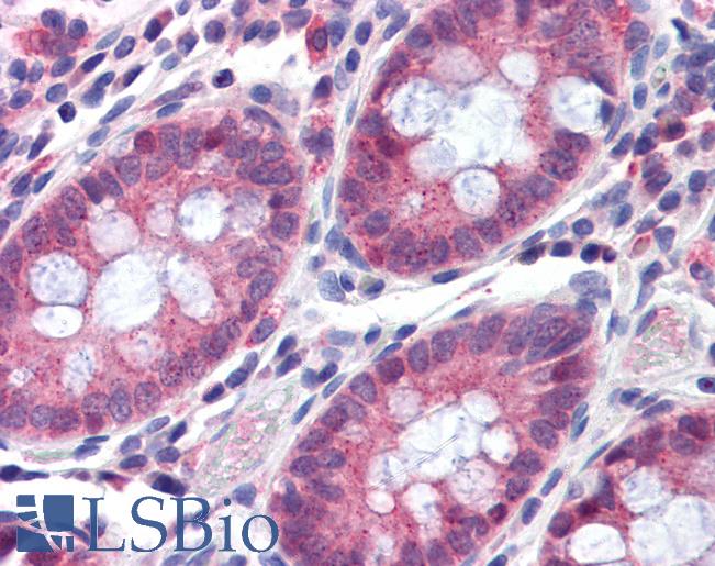 Anti-TMPRSS4 antibody LS-A9908 IHC of human colon. Immunohistochemistry of formalin-fixed, paraffin-embedded tissue after heat-induced antigen retrieval.