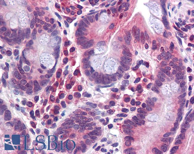Anti-TMPRSS4 antibody LS-A9909 IHC of human small intestine. Immunohistochemistry of formalin-fixed, paraffin-embedded tissue after heat-induced antigen retrieval.