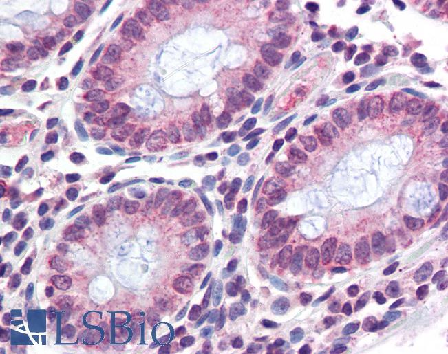 Anti-TMPRSS4 antibody LS-A9909 IHC of human colon. Immunohistochemistry of formalin-fixed, paraffin-embedded tissue after heat-induced antigen retrieval.