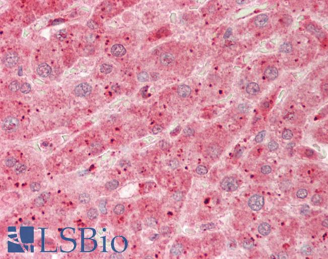 Human Liver: Formalin-Fixed, Paraffin-Embedded (FFPE)