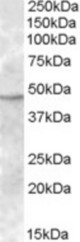 Antibody (1 ug/ml) staining of Human Bone Marrow lysate (35 ug protein in RIPA buffer). Primary incubation was 1 hour. Detected by chemiluminescence