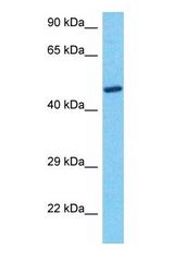 Western blot of VEGFC Antibody with human 786-0 Whole Cell lysate.