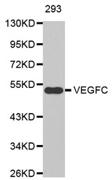 Western blot analysis of extracts of 293 cell lines, using VEGFC antibody.