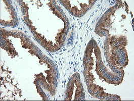 IHC of paraffin-embedded Human prostate tissue using anti-TMPRSS5 mouse monoclonal antibody. (Heat-induced epitope retrieval by 10mM citric buffer, pH6.0, 120°C for 3min).