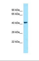 Western blot of Human NCI-H226. VEGFC antibody dilution 1.0 ug/ml.
