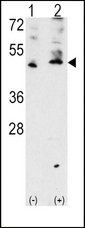 Western blot of VEGF3 Antibody polyclonal antibody(arrow). 293 cell lysates (2 ug/lane) either nontransfected (Lane 1) or transiently transfected with the VEGF3 gene (Lane 2) (Origene Technologies).
