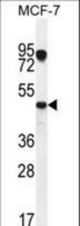 VEGF3 Antibody western blot of MCF-7 cell line lysates (35 ug/lane). The VEGF3 antibody detected the VEGF3 protein (arrow).