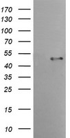 HEK293T cells were transfected with the pCMV6-ENTRY control (Left lane) or pCMV6-ENTRY TMPRSS5 (Right lane) cDNA for 48 hrs and lysed. Equivalent amounts of cell lysates (5 ug per lane) were separated by SDS-PAGE and immunoblotted with anti-TMPRSS5.