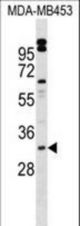 VENTX Antibody western blot of MDA-MB453 cell line lysates (35 ug/lane). The VENTX antibody detected the VENTX protein (arrow).