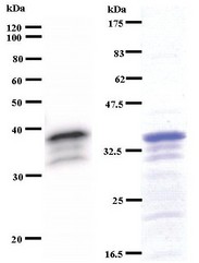 Western blot of immunized recombinant protein using ZNF161 antibody. Left: ZNF161 staining. Right: Coomassie Blue staining of immunized recombinant protein.