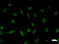 Immunostaining analysis in HeLa cells. HeLa cells were fixed with 4% paraformaldehyde and permeabilized with 0.1% Triton X-100 in PBS. The cells were immunostained with anti-ZNF161 mAb.