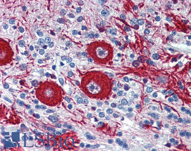 Anti-VEZF1 antibody IHC of human brain, cerebellum. Immunohistochemistry of formalin-fixed, paraffin-embedded tissue after heat-induced antigen retrieval. Antibody LS-B3981 concentration 5 ug/ml.