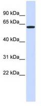 Western blot of 293T cell lysate.