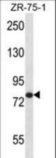 AGGF1 Antibody western blot of ZR-75-1 cell line lysates (35 ug/lane). The AGGF1 antibody detected the AGGF1 protein (arrow).