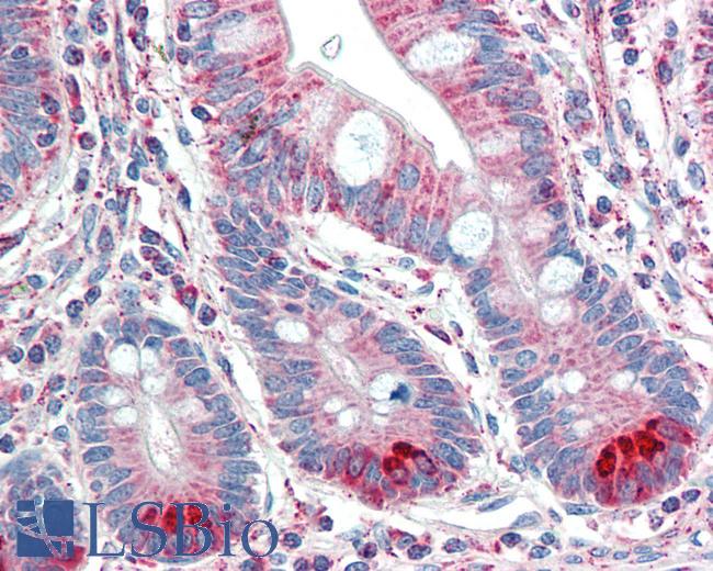 Anti-TMPRSS5 antibody IHC staining of human small intestine. Immunohistochemistry of formalin-fixed, paraffin-embedded tissue after heat-induced antigen retrieval. Antibody LS-B10272 concentration 5 ug/ml.
