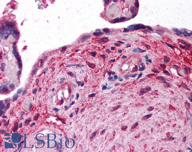 Anti-AGGF1 antibody IHC of human placenta. Immunohistochemistry of formalin-fixed, paraffin-embedded tissue after heat-induced antigen retrieval. Antibody LS-B226 dilution 1:200.