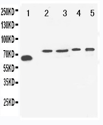 WB of VGF antibody. Lane 1: Rat Brain Tissue. Lane 2: U87 Cell Lysate. Lane 3: U87 Cell Lysate. Lane 4: SHG Cell Lysate. Lane 5: NEURO Cell Lysate.