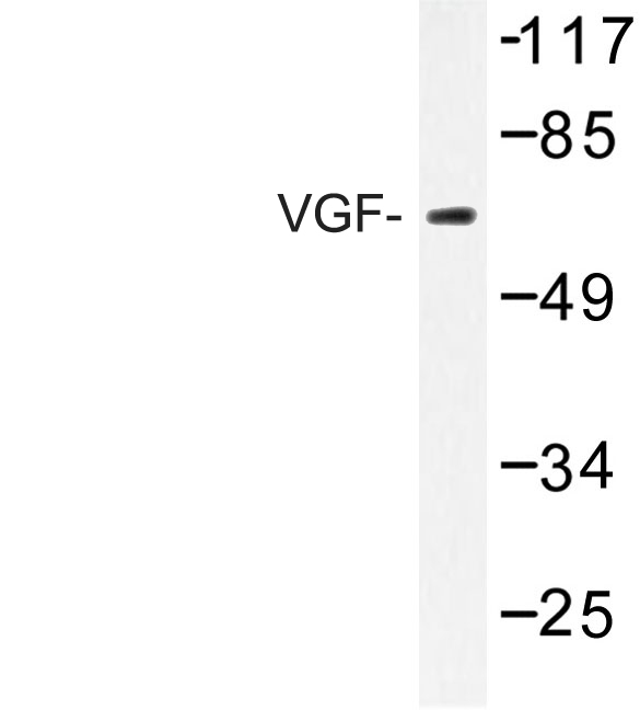 Western blot of VGF (K458) pAb in extracts from RAW264.7 cells.