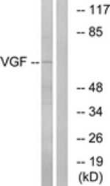 Western blot of extracts from RAW264.7 cells, using VGF Antibody. The lane on the right is treated with the synthesized peptide.